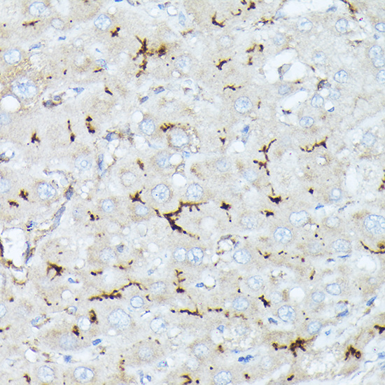 Immunohistochemistry of paraffin-embedded human liver using CD10/MME Polyclonal Antibody at dilution of 1:50 (40x lens).Perform high pressure antigen retrieval with 10 mM citrate buffer pH 6.0 before commencing with IHC staining protocol.