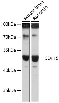 Western blot analysis of extracts of various cell lines using CDK15 Polyclonal Antibody at 1:3000 dilution.