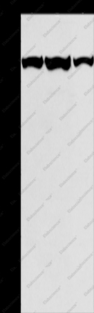 MCM3 Polyclonal Antibody - 1