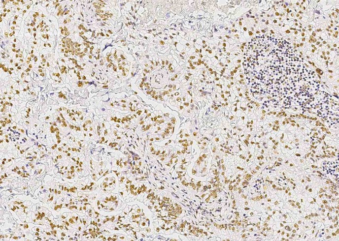 Recombinant STK4/MST1 Monoclonal Antibody-searchlist-1