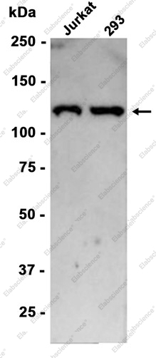Recombinant RNF20 Monoclonal Antibody - 1
