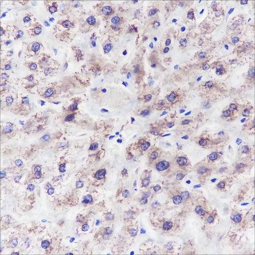 Recombinant GLUD1 Monoclonal Antibody - small - 2