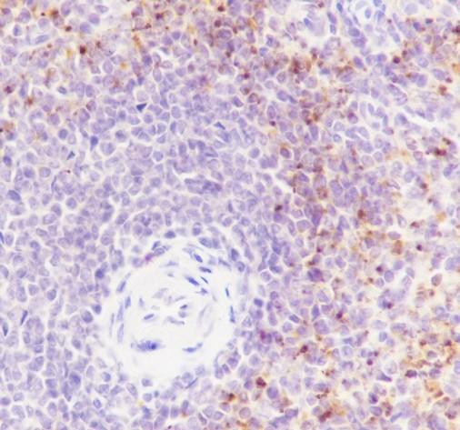Recombinant PF4 Monoclonal Antibody-searchlist-2