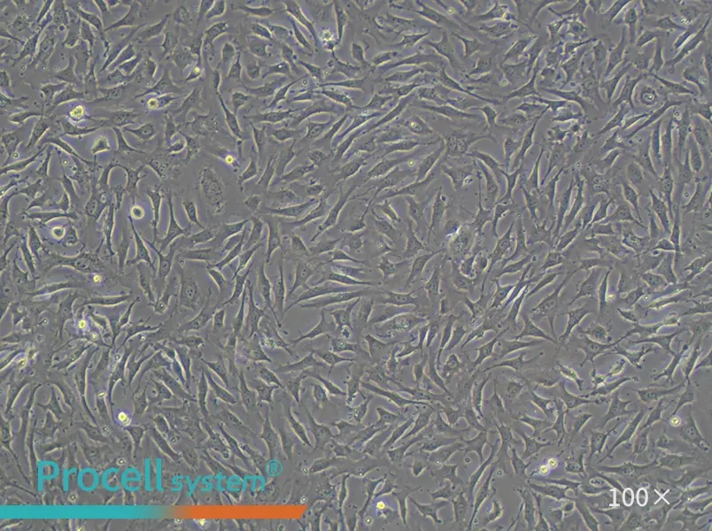 EA.hy926 Cell Complete Medium - 3