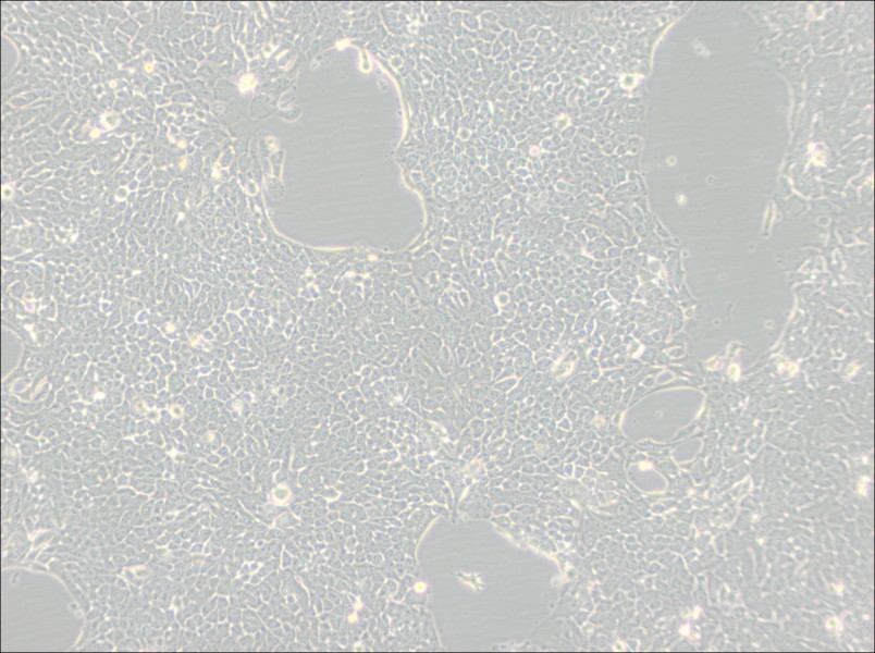 Detroit 562 Cell Complete Medium-searchlist-1