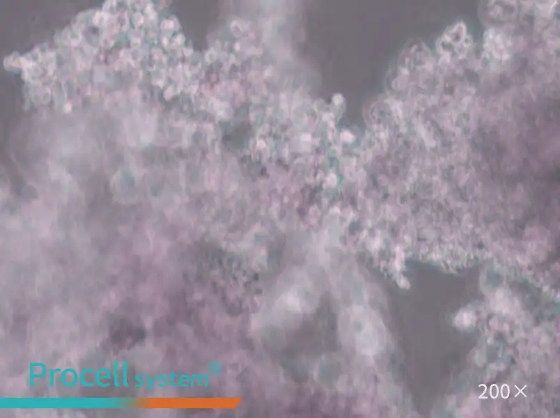 NCI-H660 Cell Complete Medium - 5