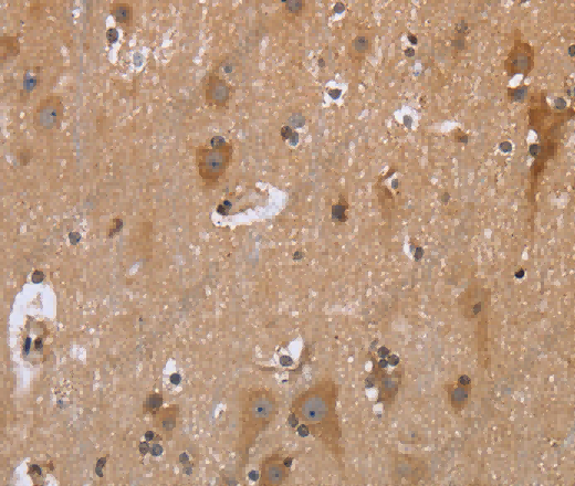 GABPB2 Polyclonal Antibody - 3