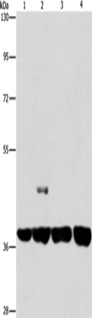 Western Blot analysis of 293T and 231 cell, U937 and Raji cell using SERPINA9 Polyclonal Antibody at dilution of 1:350