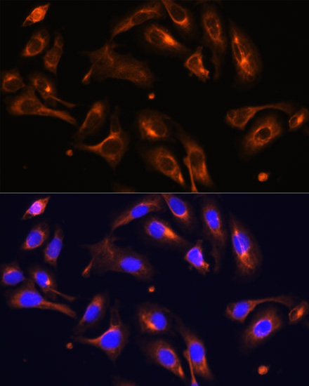 Immunofluorescence analysis of U-2 OS cells using MLPH Polyclonal Antibody at dilution of 1:100. Blue: DAPI for nuclear staining.