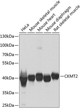 Western blot analysis of extracts of various cell lines using CKMT2 Polyclonal Antibody at 1:1000 dilution.