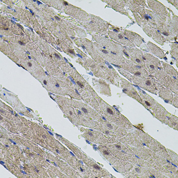 Immunohistochemistry of paraffin-embedded Rat heart using MYC Polyclonal Antibody at dilution of 1:100 (40x lens).