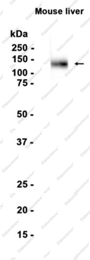 Recombinant LAMP1 Monoclonal Antibody - 1
