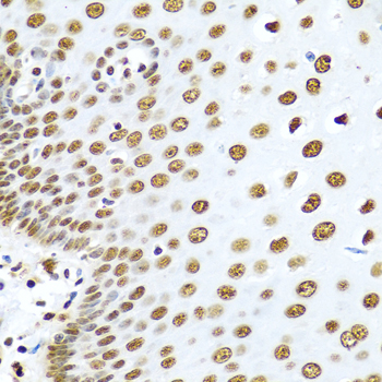 Immunohistochemistry of paraffin-embedded Human esophagus using HNRNPR Polyclonal Antibody at dilution of 1:100 (40x lens).