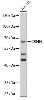 Western blot analysis of extracts of HepG2 cells using CRNN Polyclonal Antibody at 1:1000 dilution.