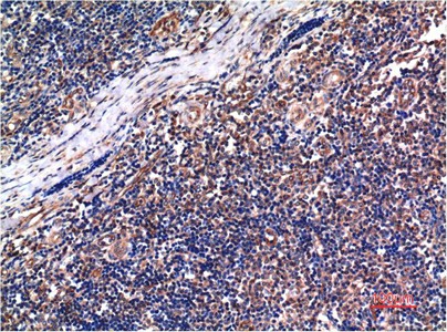 Immunohistochemistry of paraffin-embedded Human tonsil tissue using Cyclin B1 Monoclonal Antibody at dilution of 1:200.