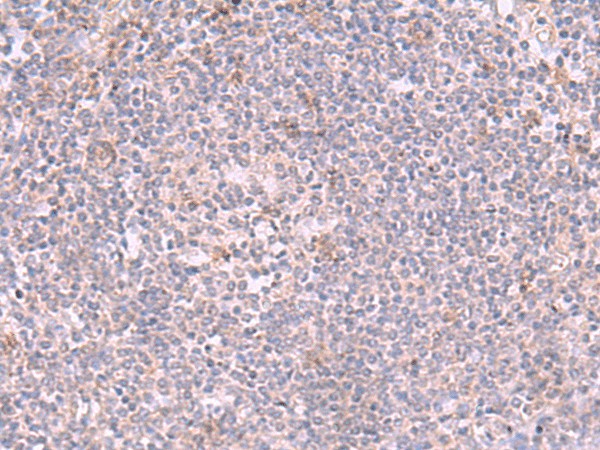 Immunohistochemistry of paraffin-embedded Human tonsil tissue  using INPP5K Polyclonal Antibody at dilution of 1:90(?200)