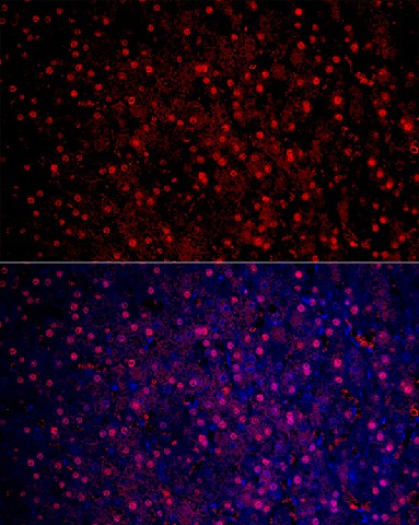 Immunofluorescence analysis of human liver cancer cells using Arginase 1  (ARG1) Polyclonal Antibody at dilution of 1:50 (40x lens). Blue: DAPI for nuclear staining.