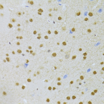 Immunohistochemistry of paraffin-embedded mouse brain using ANP32A Polyclonal antibody at dilution of 1:100 (40x lens).Perform microwave antigen retrieval with 10 mM PBS buffer pH 7.2 before commencing with IHC staining protocol.