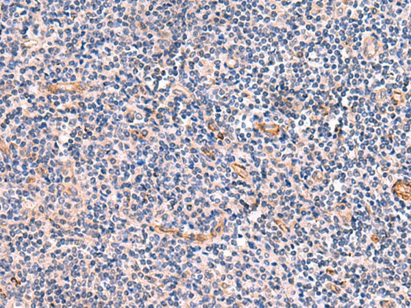 Immunohistochemistry of paraffin-embedded Human tonsil tissue  using INSM2 Polyclonal Antibody at dilution of 1:35(?200)