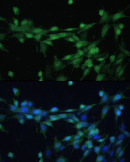 Immunofluorescence analysis of NIH-3T3 cells using CSNK2B Polyclonal Antibody at dilution of  1:100 (40x lens). Blue: DAPI for nuclear staining.