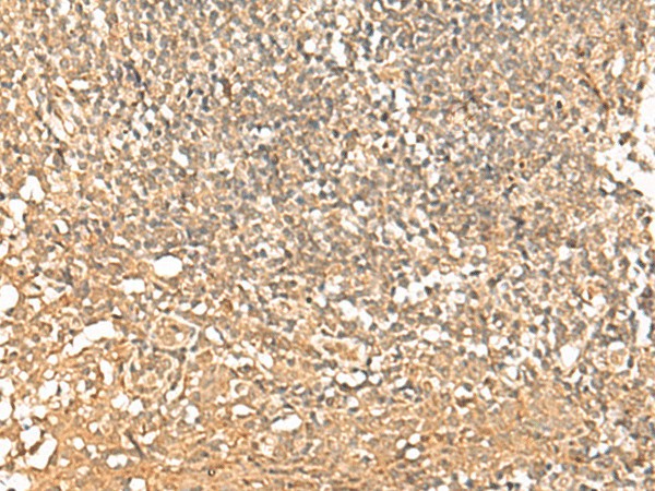 Immunohistochemistry of paraffin-embedded Human tonsil tissue  using PWP1 Polyclonal Antibody at dilution of 1:50(?200)