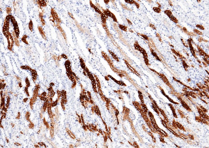 Recombinant MEP1A Monoclonal Antibody-searchlist-1