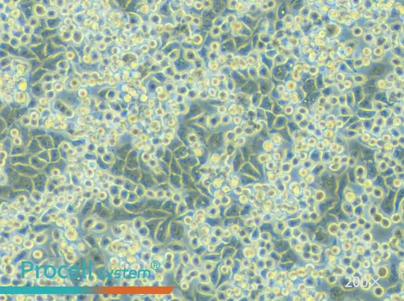 NCI-H2122 Cell Complete Medium - 4