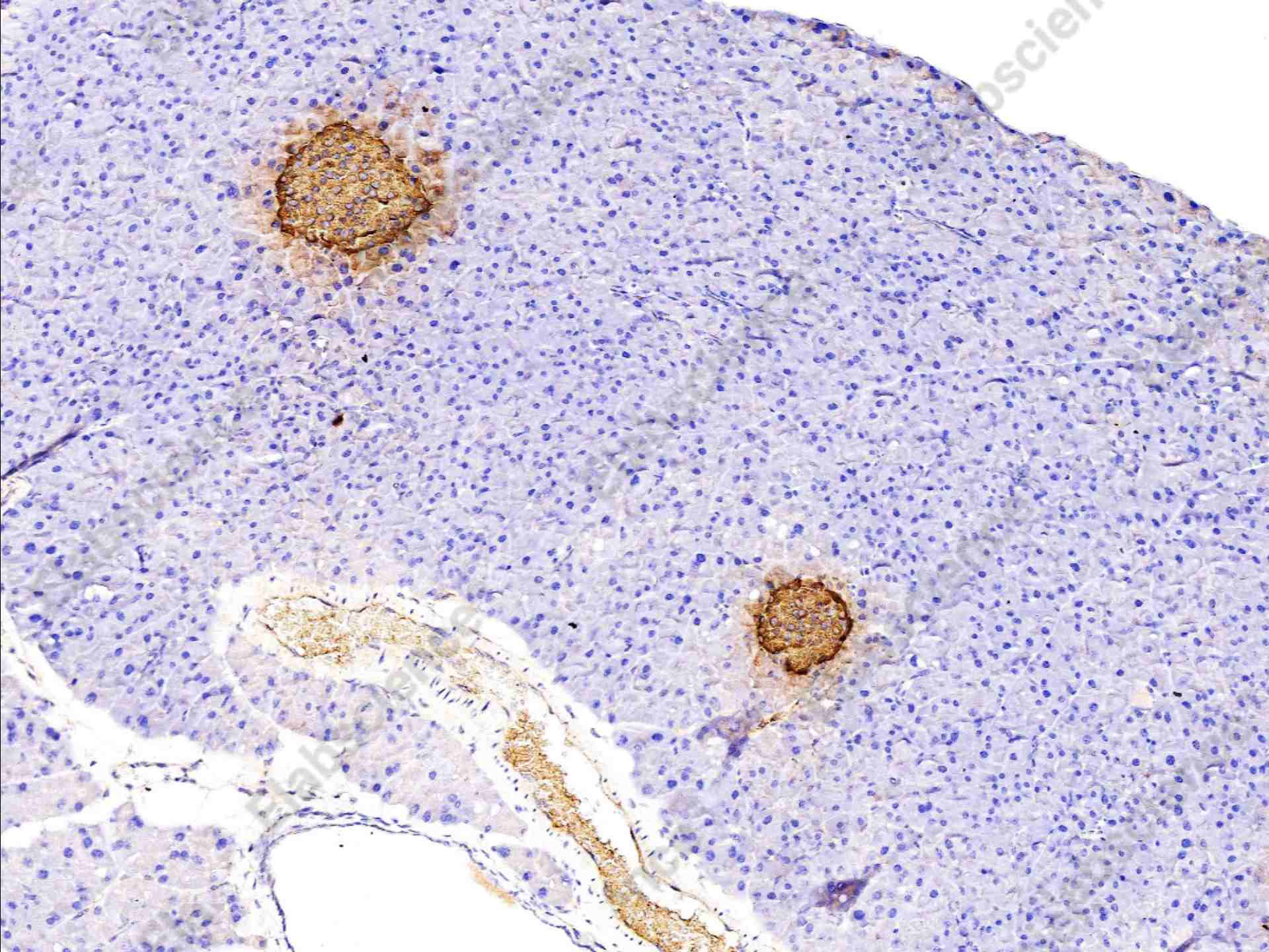 Recombinant Insulin Monoclonal Antibody - 3