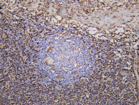 Recombinant Annexin I Monoclonal Antibody - 1