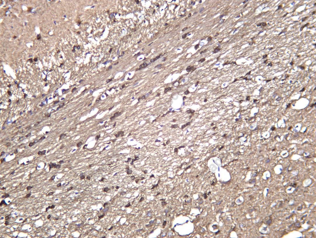 Recombinant TBB4A Monoclonal Antibody - 4