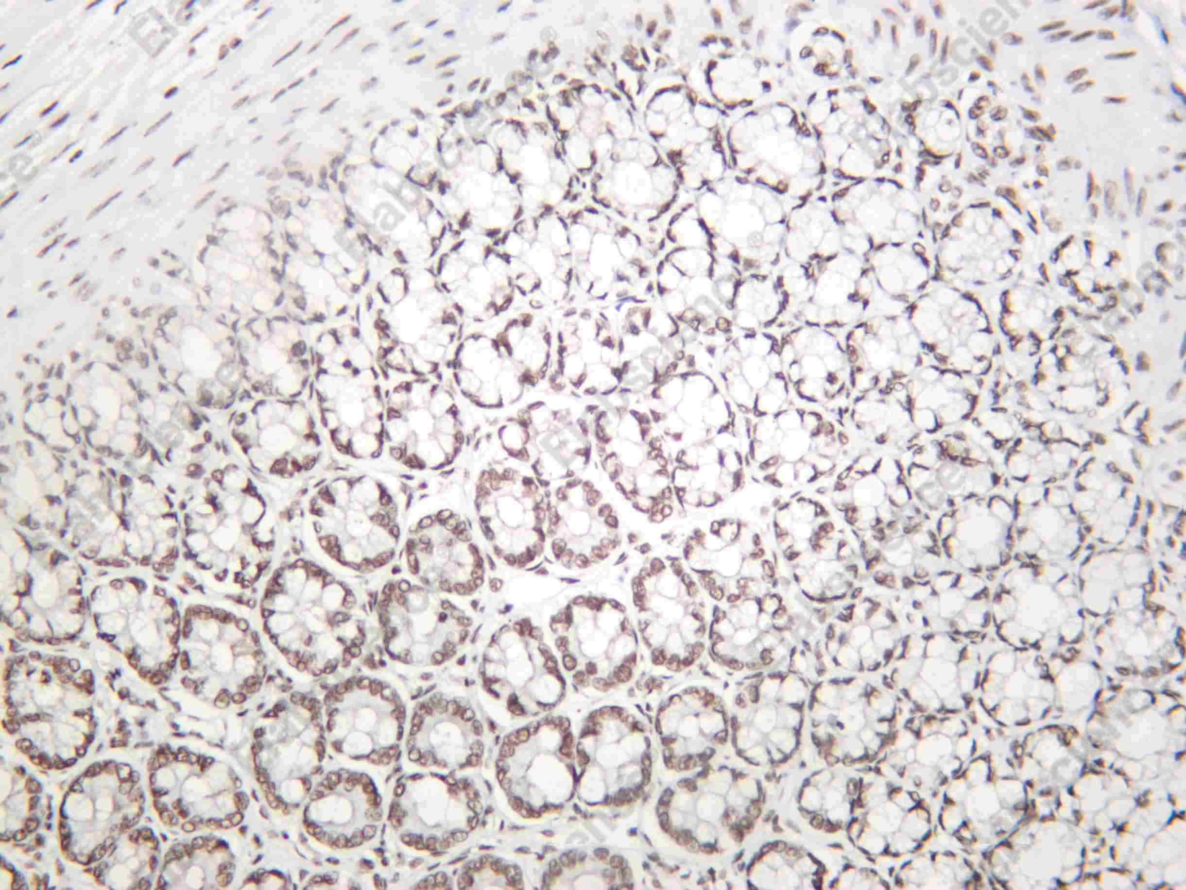 Recombinant BCKDK Monoclonal Antibody - 2