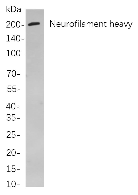 Recombinant Neurofilament heavy polypeptide Monoclonal Antibody-searchlist-1
