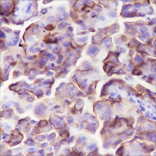 Recombinant NaPi2b Monoclonal Antibody-searchlist-1