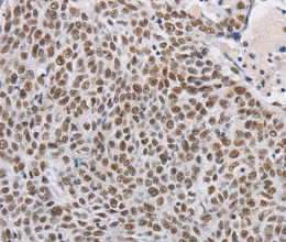 THOC7 Polyclonal Antibody - 2