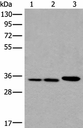 Western blot analysis of A549 Hela and K562 cell lysates  using RPF2 Polyclonal Antibody at dilution of 1:400