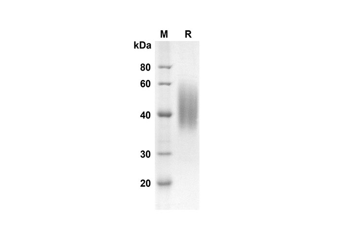 Recombinant Mouse IL-10 Protein(His Tag)-产品推荐-1