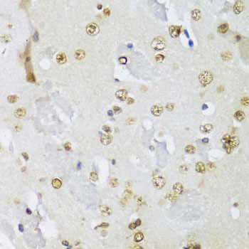 Immunohistochemistry of paraffin-embedded mouse brain using IKKε Polyclonal antibody at dilution of 1:100 (40x lens).Perform microwave antigen retrieval with 10 mM PBS buffer pH 7.2 before commencing with IHC staining protocol.