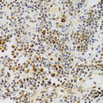 Immunohistochemistry of paraffin-embedded Human appendicitis using NASP Polyclonal Antibody at dilution of 1:100 (40x lens).