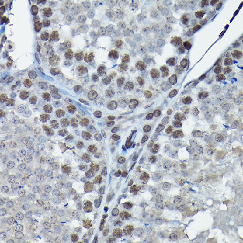 Immunohistochemistry of paraffin-embedded rat testis using CDK4 Polyclonal Antibody at dilution of 1:100 (40x lens).Perform high pressure antigen retrieval with 10 mM citrate buffer pH 6.0 before commencing with IHC staining protocol.