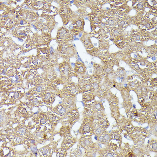 Immunohistochemistry of paraffin-embedded rat liver using CDK5RAP1 Polyclonal Antibody at dilution of 1:100 (40x lens).Perform microwave antigen retrieval with 10 mM PBS buffer pH 7.2 before commencing with IHC staining protocol.