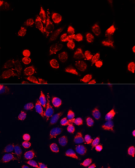 Immunofluorescence analysis of HeLa cells using NFE2L1 Polyclonal Antibody at dilution of 1:100. Blue: DAPI for nuclear staining.