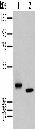 Western blot analysis of Human fetal brain tissue and Human kidney tissue  using IDO2 Polyclonal Antibody at dilution of 1:450