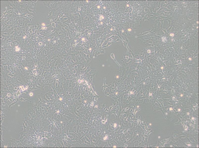 TE-10 Cell Complete Medium - 2