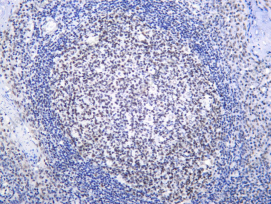 Recombinant MBD2 Monoclonal Antibody - 1