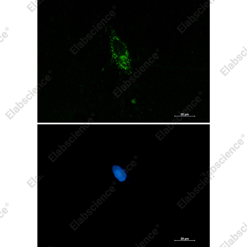 Recombinant Pumilio 1 Monoclonal Antibody - 2