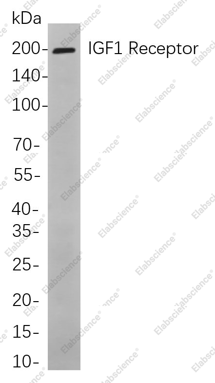 Recombinant IGF1 Receptor Monoclonal Antibody - 1