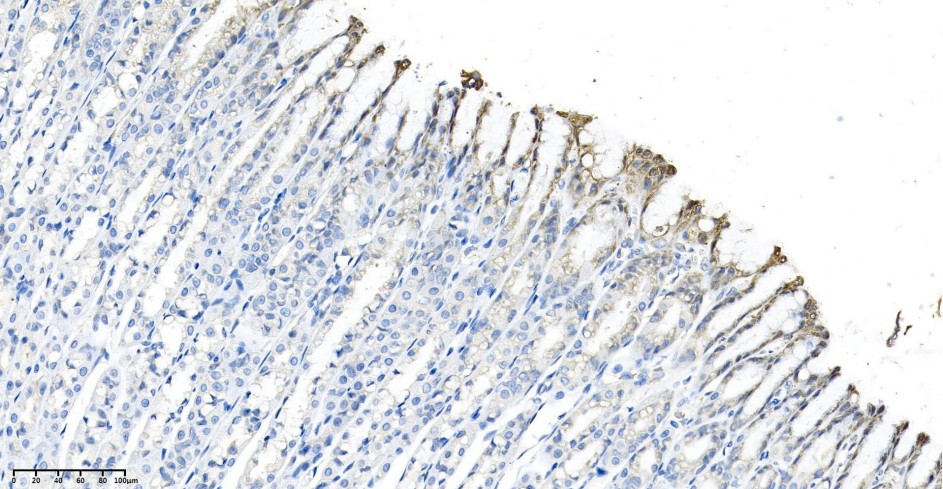 Recombinant Calreticulin Monoclonal Antibody - small - 3