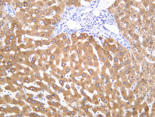 Recombinant MBL Monoclonal Antibody - 1