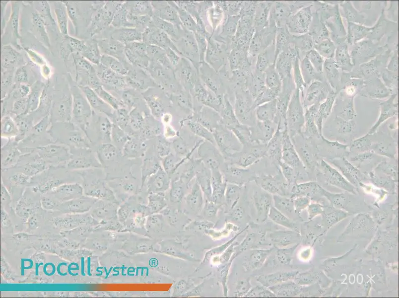 SJSA-1 Cell Complete Medium - small - 4