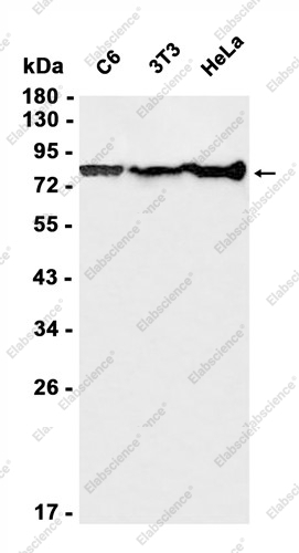 Recombinant PFKP Monoclonal Antibody - 1